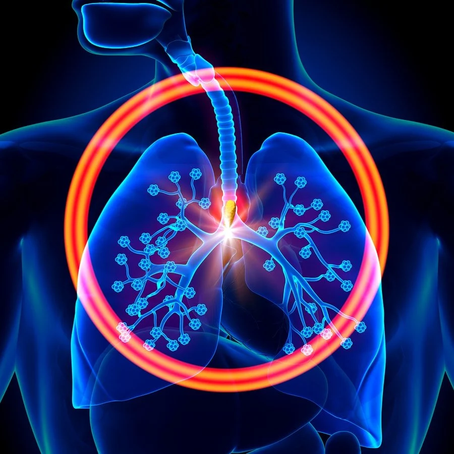 Hypercapnia, hypoxia Cyanosis | CHAPTER 4 | Anatomy and Physiology