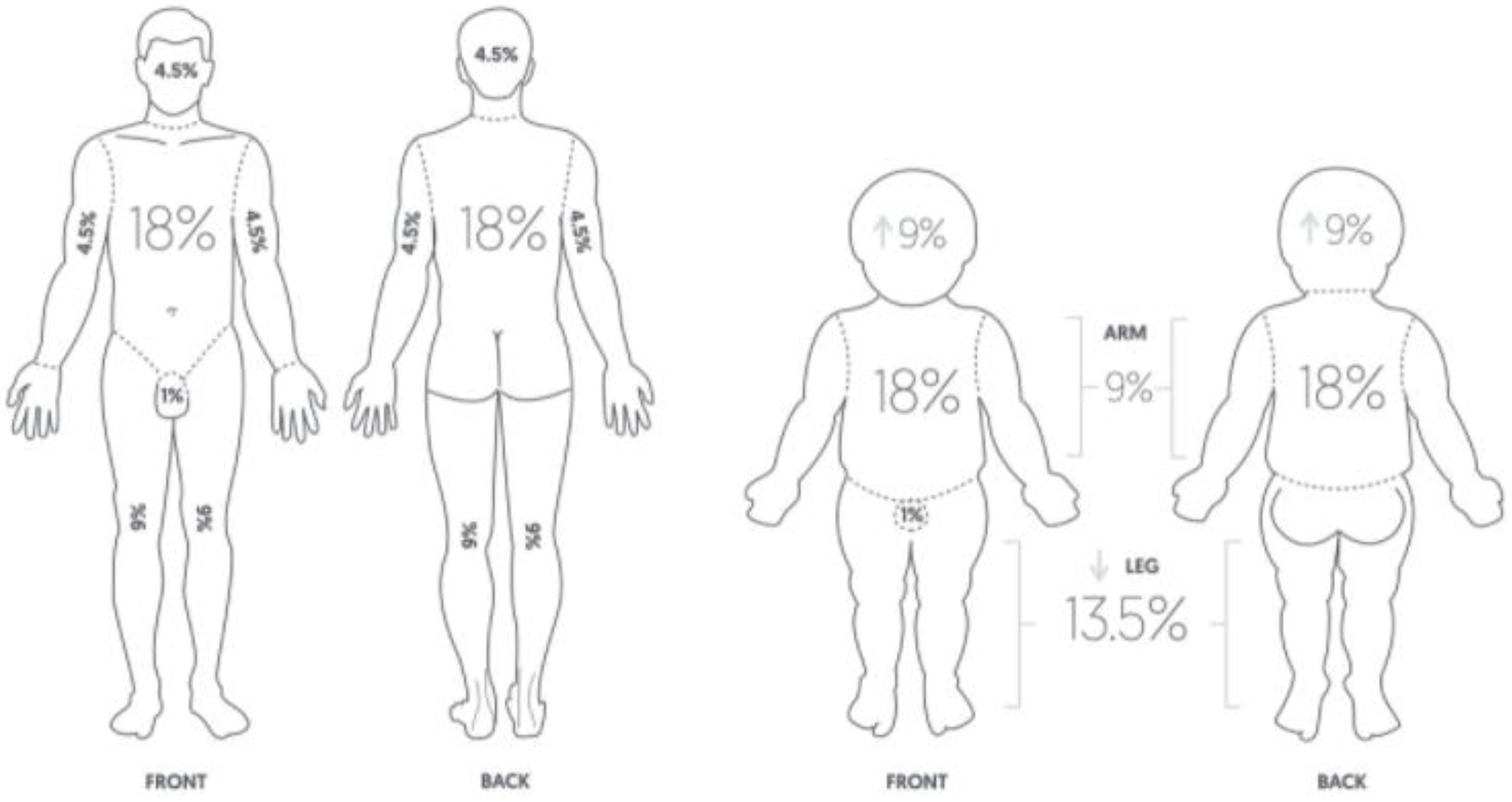The rule of nine | CHAPTER 11 | Anatomy and Physiology