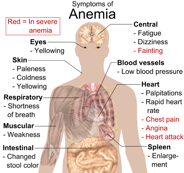 Concept of Anemia | CHAPTER 11 | Pediatric Nursing