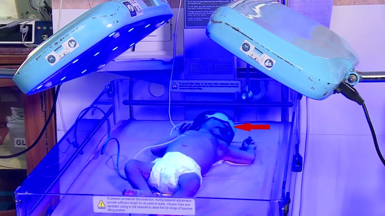 Classification of Phototherapy