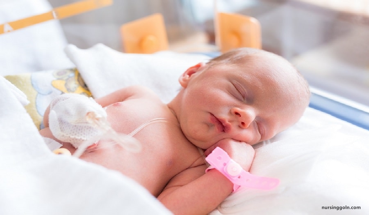 Pathological jaundice | CHAPTER 18 | Pediatric Nursing