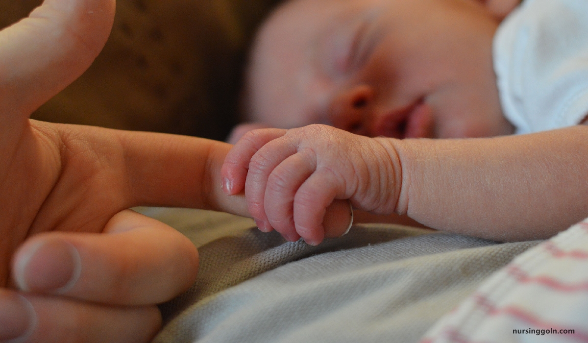 Pathological jaundice | CHAPTER 18 | Pediatric Nursing