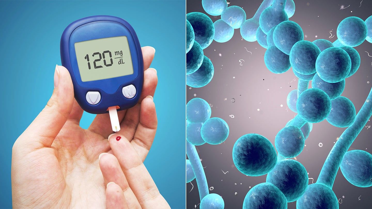 Medical Diabetes Insipidus | CHAPTER 13 | Pediatric Nursing