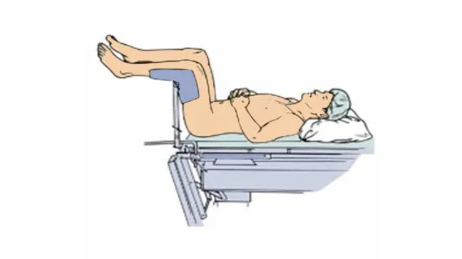Concept About Positioning | CHAPTER 22 | Orthopedic Nursing