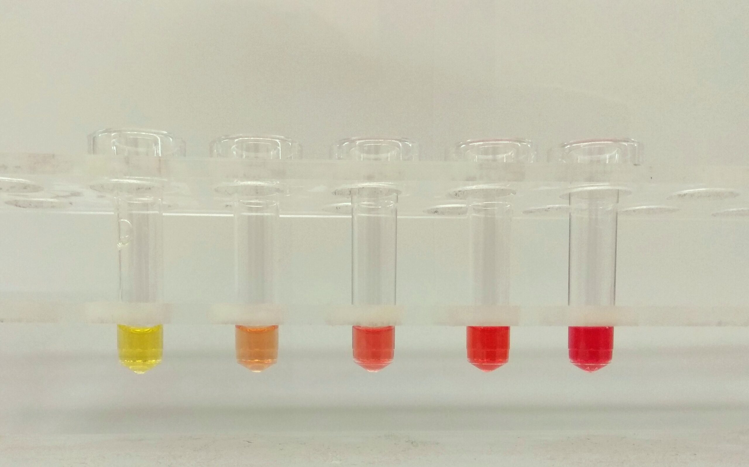 Classification of Hemolytic disease of the newborn