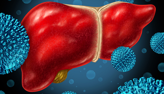 Hepatitis