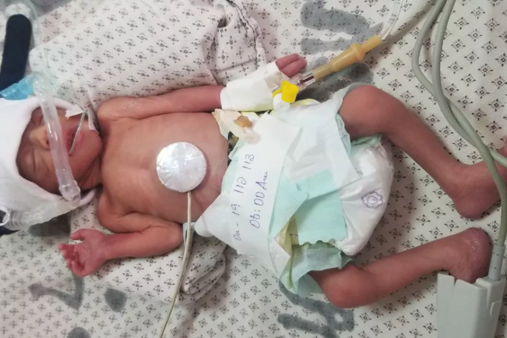 High risk newborn