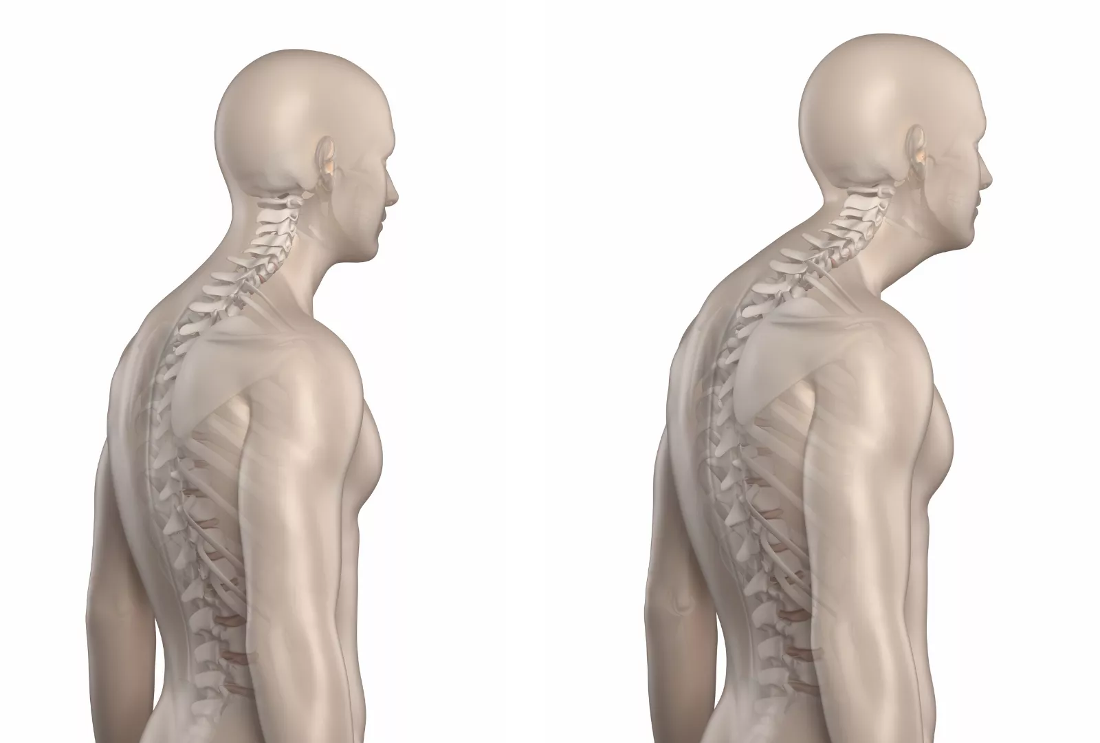 Important orthopedic terminology | CHAPTER 23 | Orthopedic Nursing
