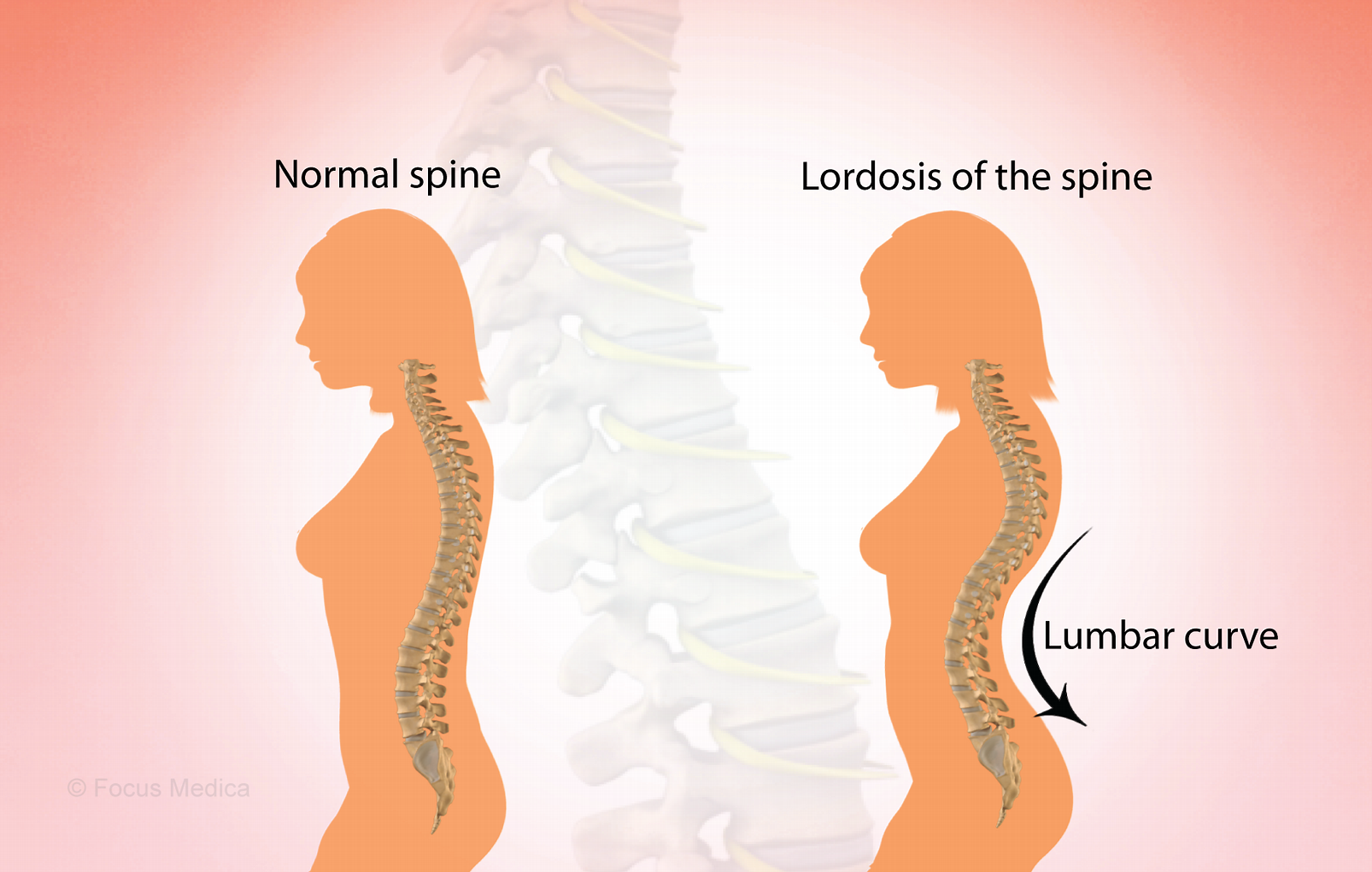 Important orthopedic terminology | CHAPTER 23 | Orthopedic Nursing