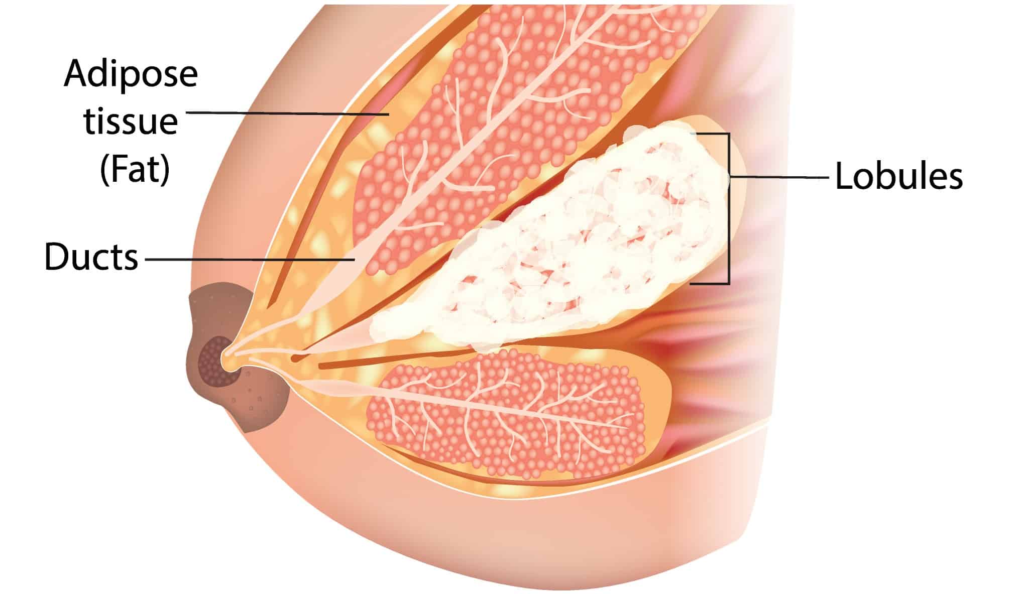 Concept about Mastitis
