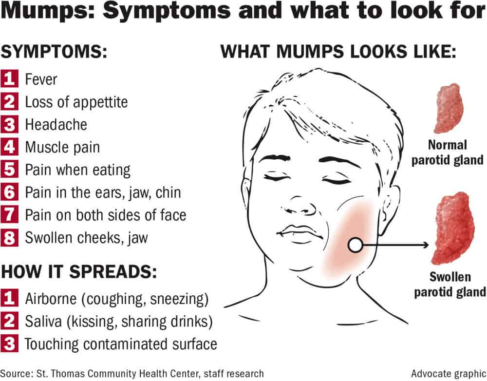 Concept about Mumps | CHAPTER 13 | Pediatric Nursing