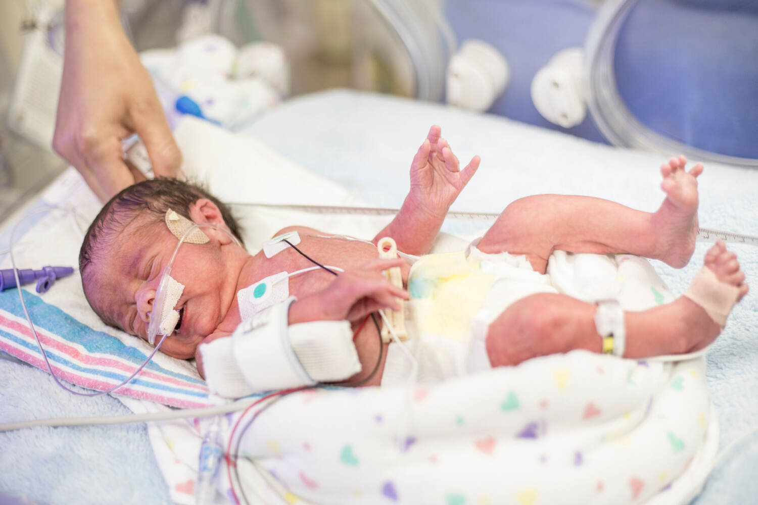 Neonatal convulsion/seizure