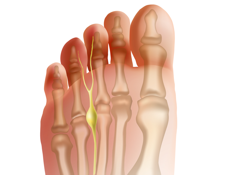 Important orthopedic terminology | CHAPTER 23 | Orthopedic Nursing