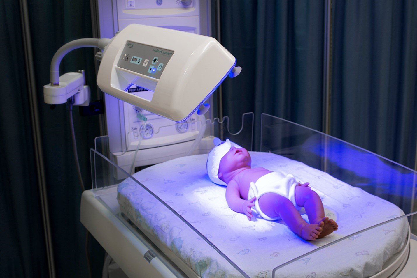 Classification of Physiological jaundice
