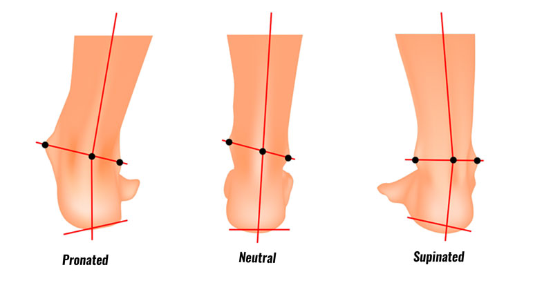 Important orthopedic terminology | CHAPTER 23 | Orthopedic Nursing