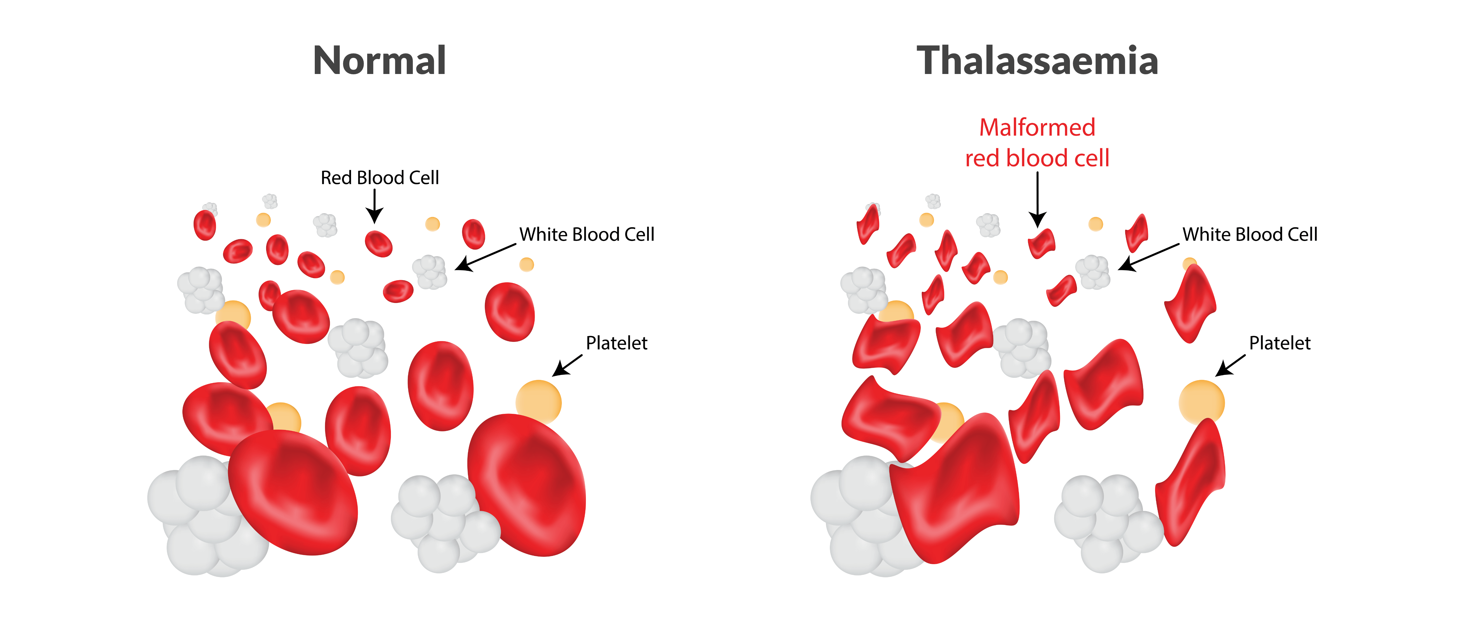 Concept about Thalassemia | CHAPTER 11 | Pediatric Nursing
