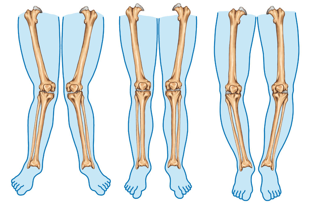 Important orthopedic terminology | CHAPTER 23 | Orthopedic Nursing
