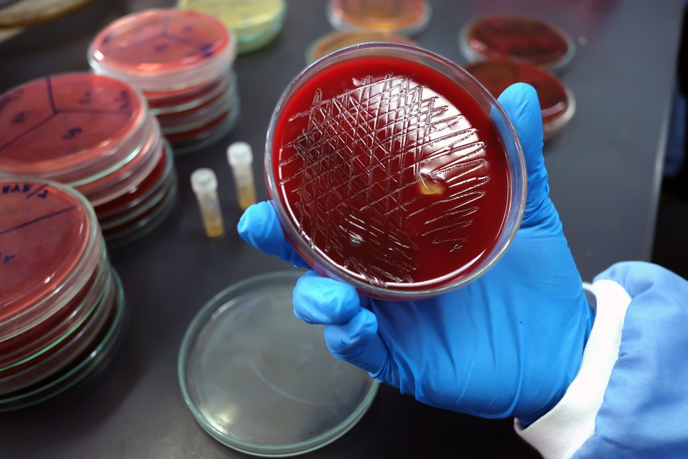 Concept about Blood Culture