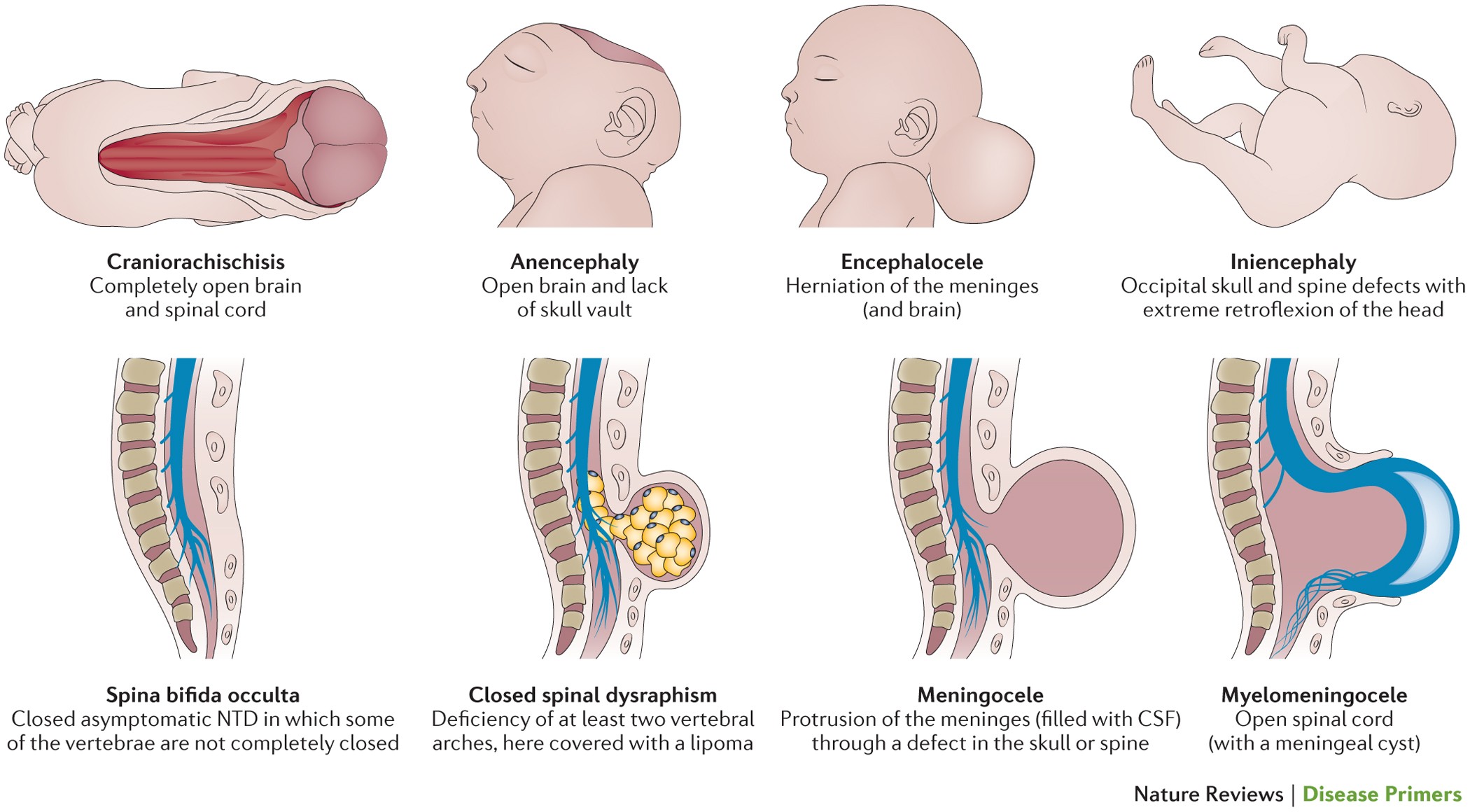 Chromosomal abnormalities | CHAPTER 8 | Pediatric Nursing