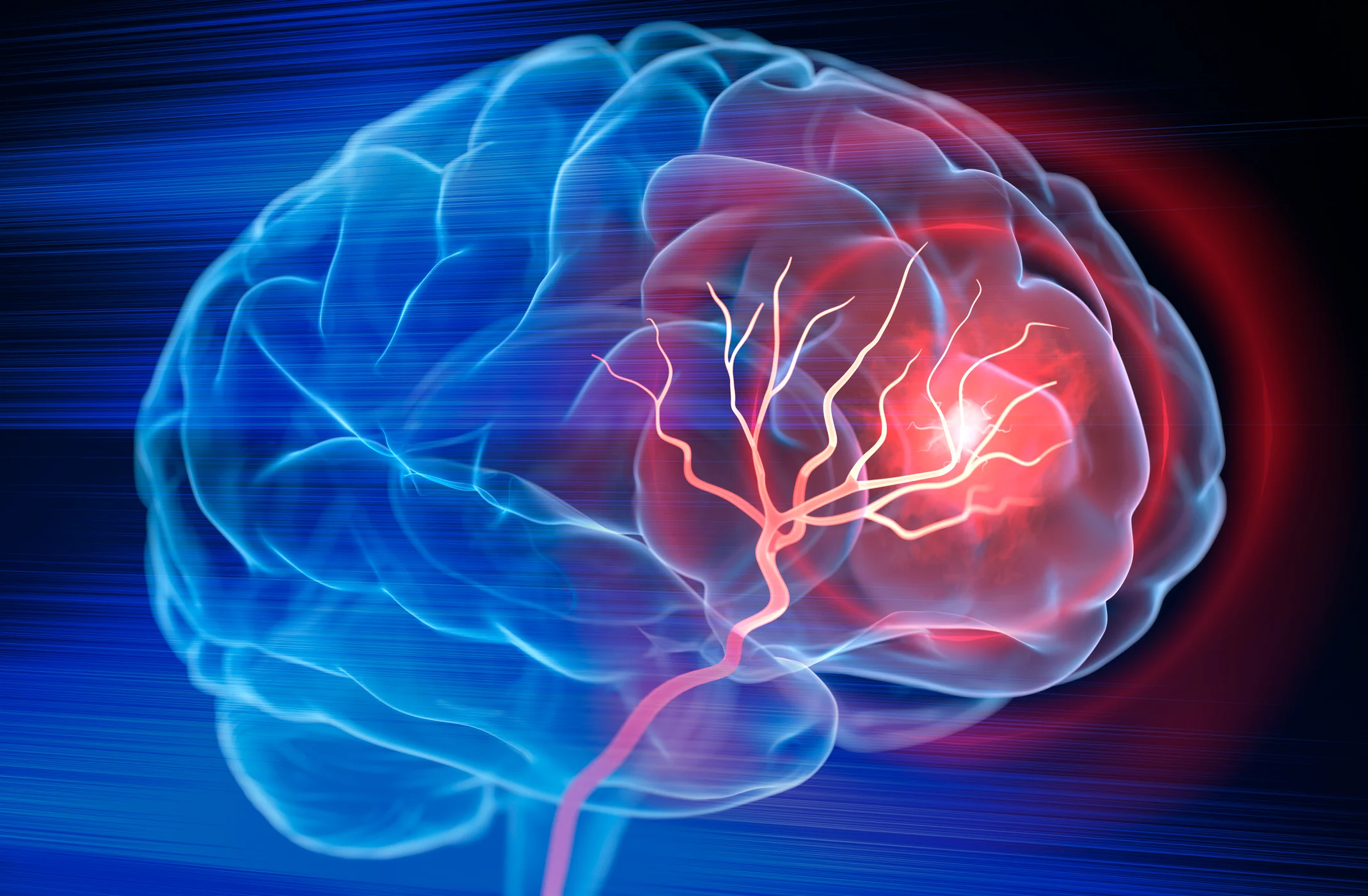 Concept about Epilepsy | CHAPTER 7 | Pediatric Nursing