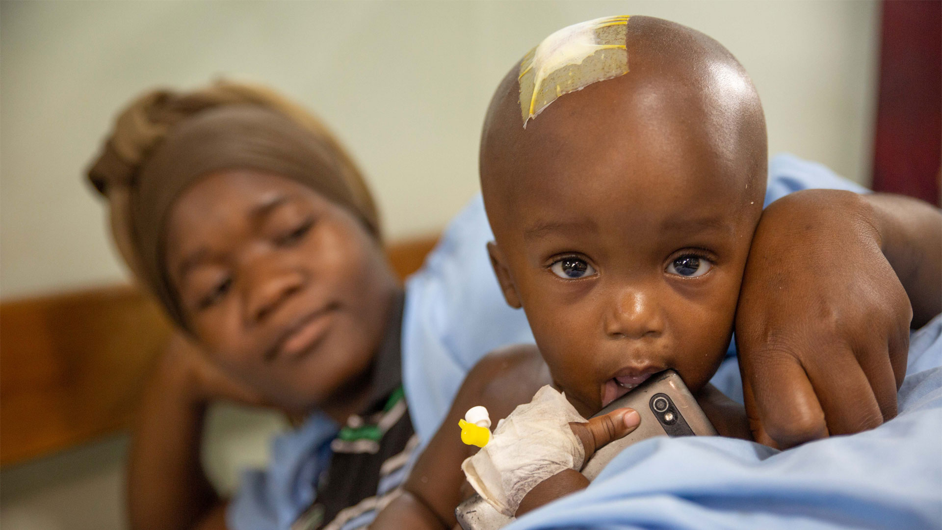 Concept about Hydrocephalus | CHAPTER 8 | Pediatric Nursing