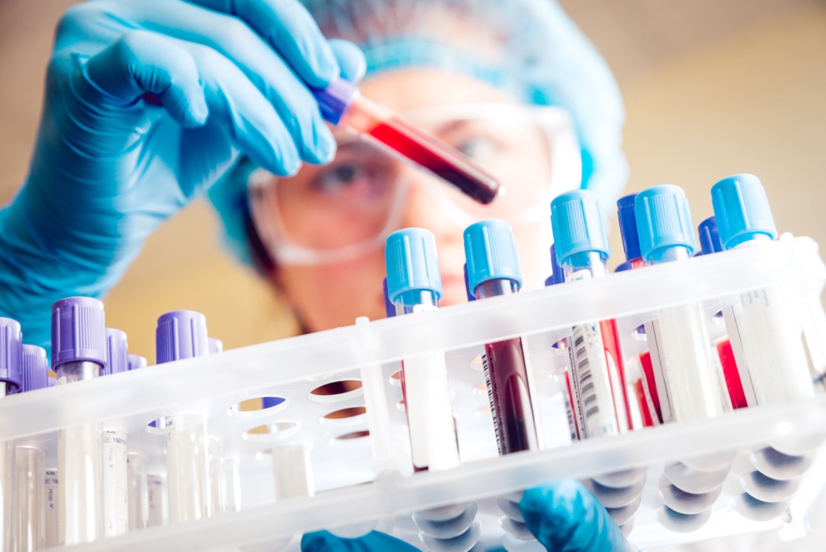 Diagnostic test and investigation
