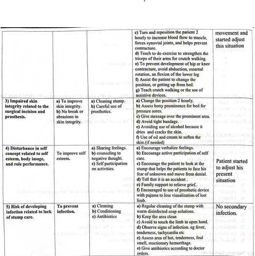 Definition of Amputation | CHAPTER 8 | Orthopedic Nursing