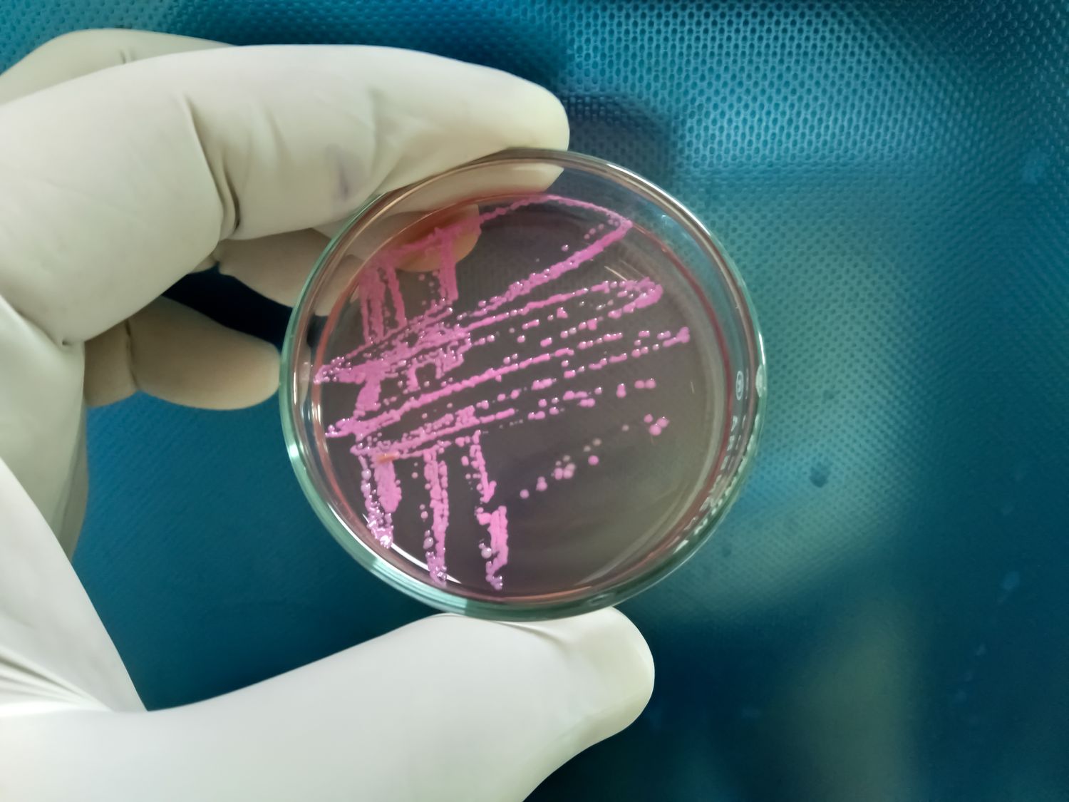 Stool Culture