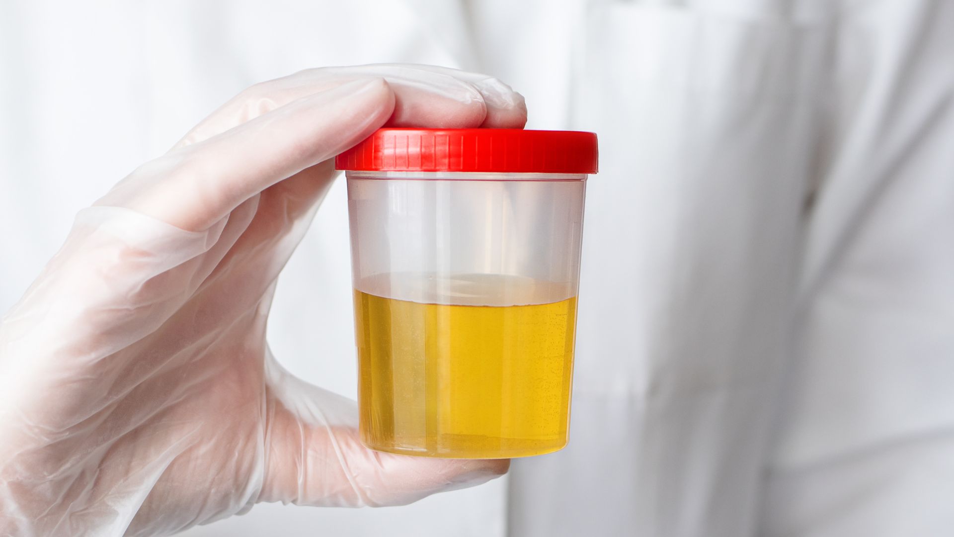 Concept about Urine Culture