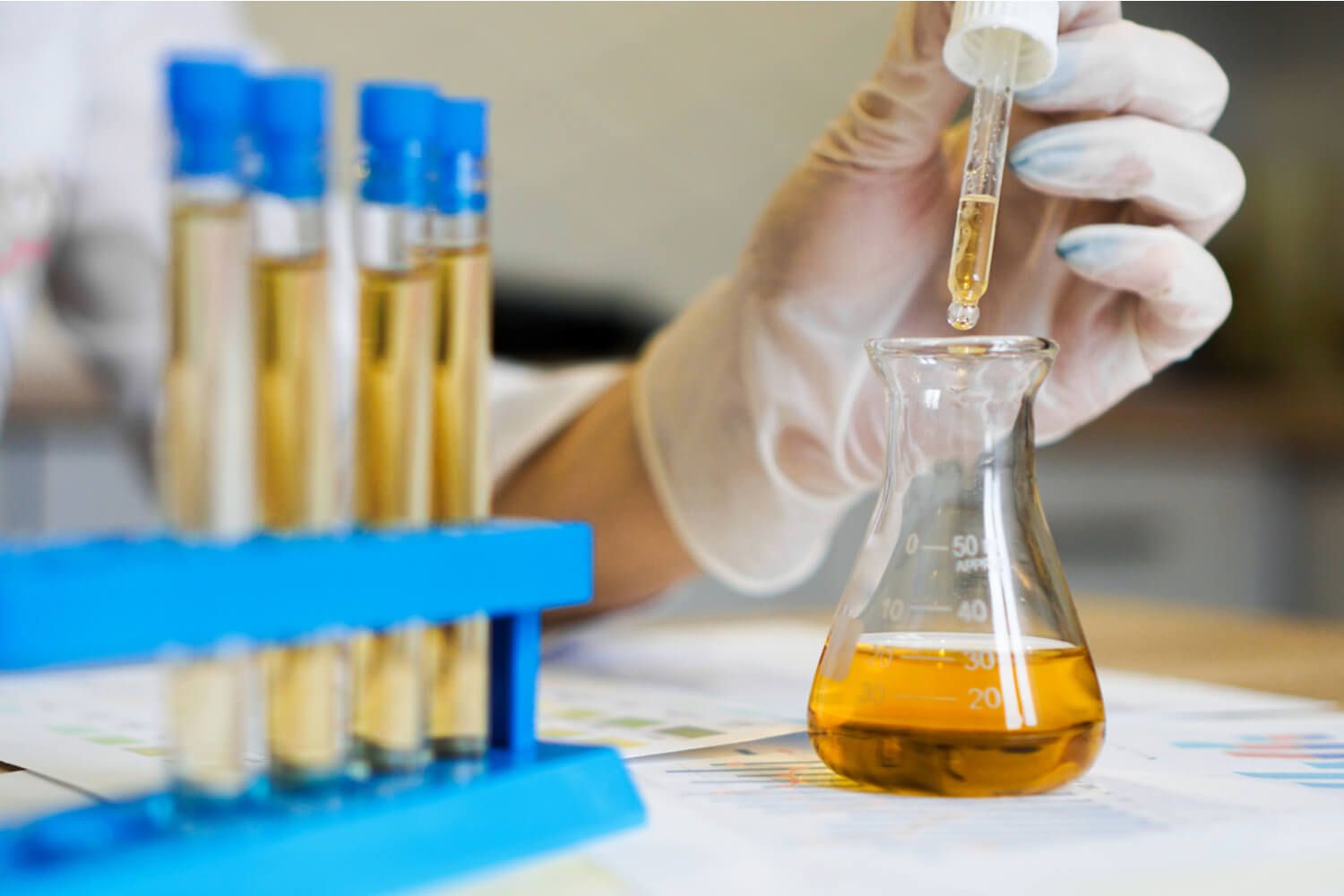 Concept about Urine Culture