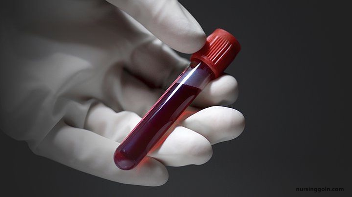 Blood Typing - The Cardiovascular System: Blood