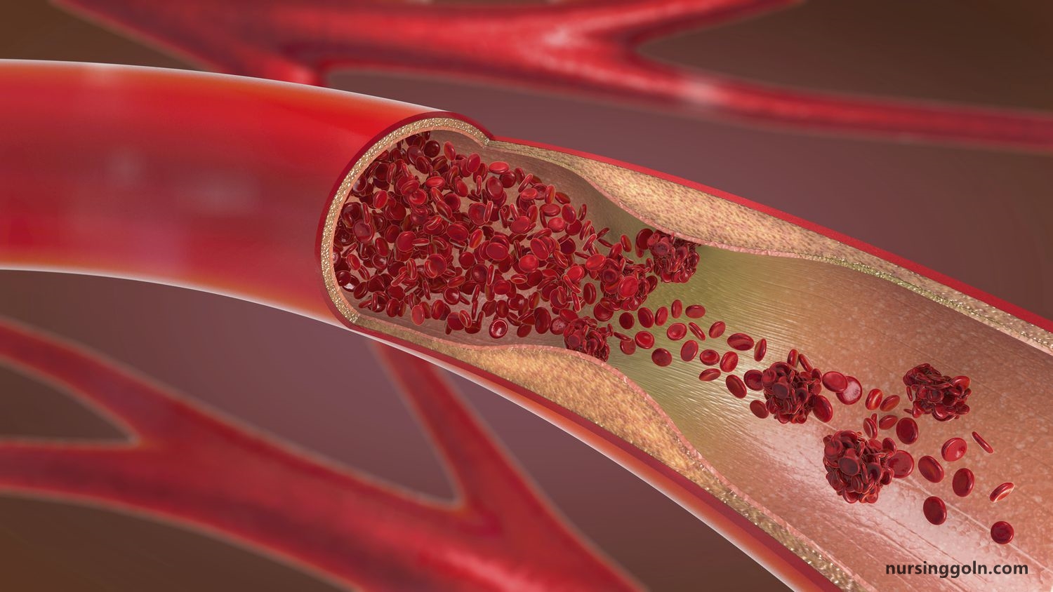 The Immune Response against Pathogens: The Lymphatic and Immune System