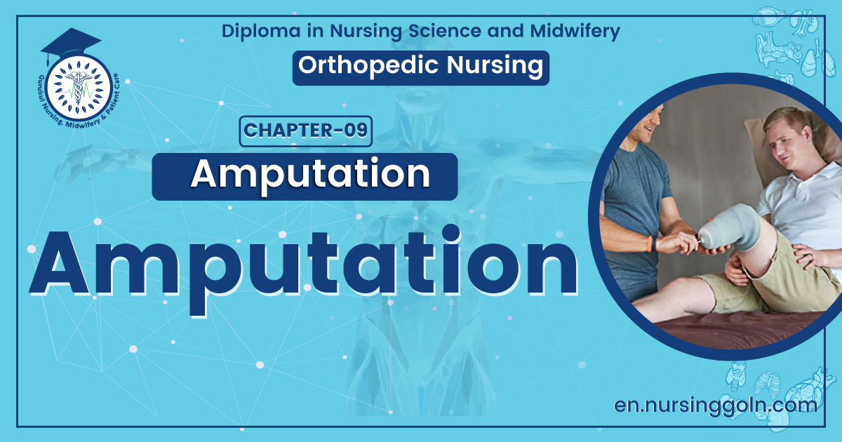 Definition of Amputation | CHAPTER 8 | Orthopedic Nursing
