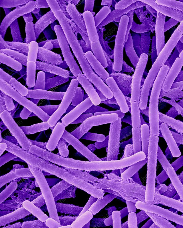 bacillus anthracis