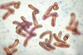 Medical Definition of Diarrhea l Chapter 5 l Medical And Surgical Nursing