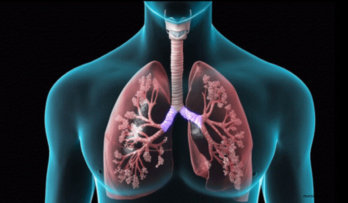 Chronie Obstructive Pulmonary Disease (COPD) | CHAPTER-8 | Medical and Surgical Nursing