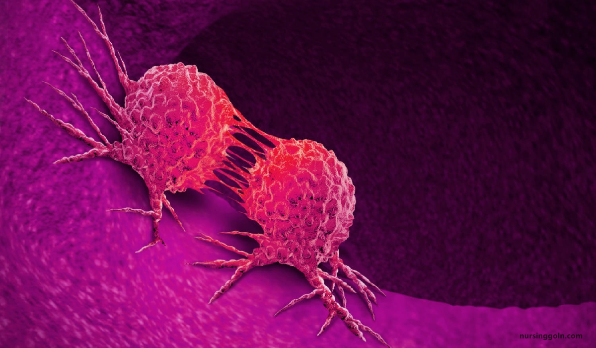 Classification of cancer | CHAPTER-12 | Medical and Surgical Nursing