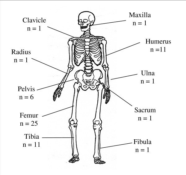 Concept about Osteosarcoma | CHAPTER 15 | Orthopedic Nursing