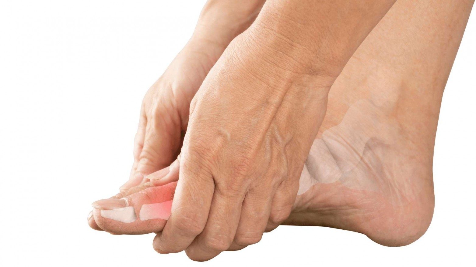 Concept about Osteoarthritis | CHAPTER 13 | Orthopedic Nursing