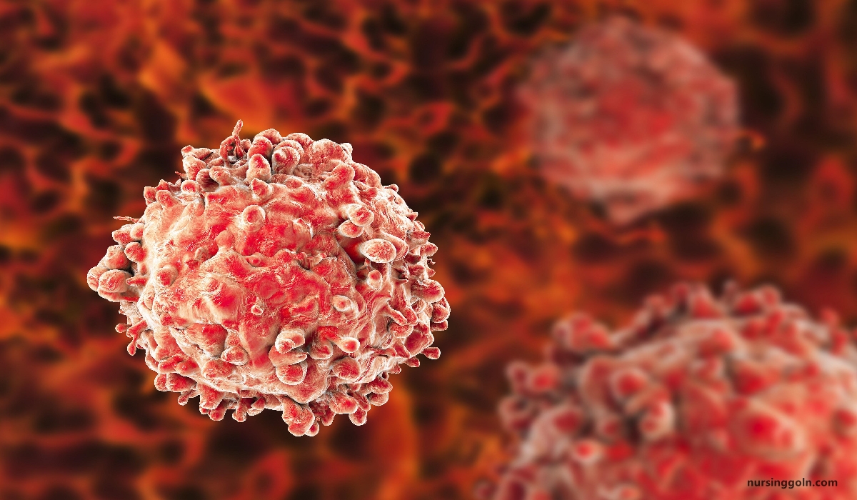 Concept of Leukemia | CHAPTER-10 | Medical and Surgical Nursing