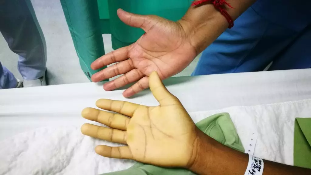 Definition of Anaemia | CHAPTER-19: General Examination | Fundamentals of Nursing