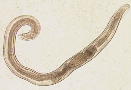 Tape worm