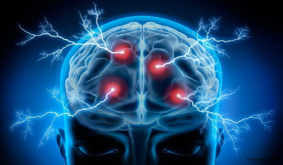 Concept of Epilepsy | CHAPTER-14 | Medical and Surgical Nursing