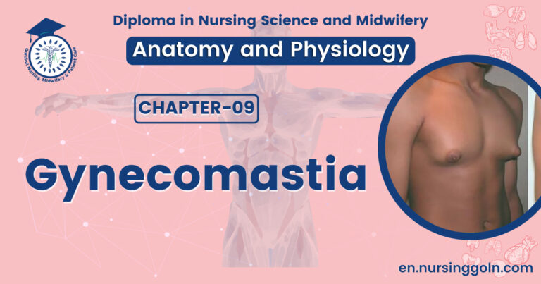 Gynecomastia