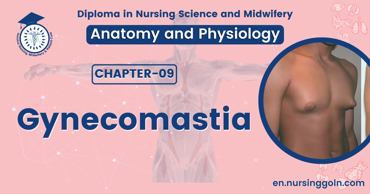 Gynecomastia