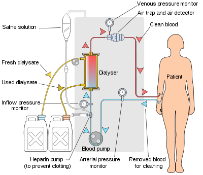 hemodialysis machine