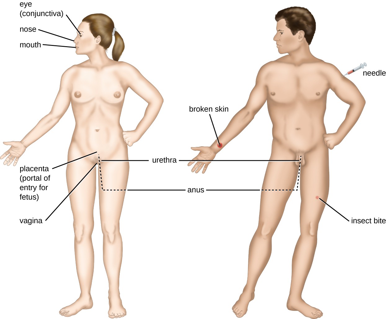 Human disease