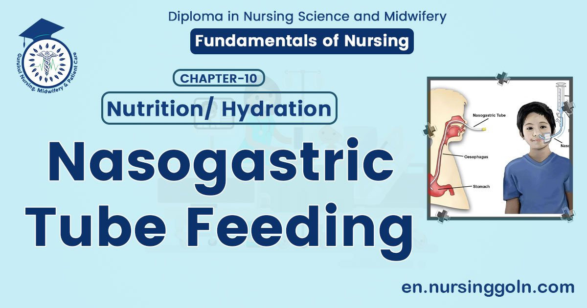 Nasogastric Tube Feeding | CHAPTER 10 | Fundamentals of Nursing