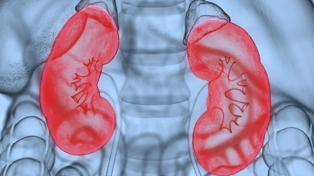 Nephrotic Syndrome | Chapter 7 | Medical And Surgical Nursing