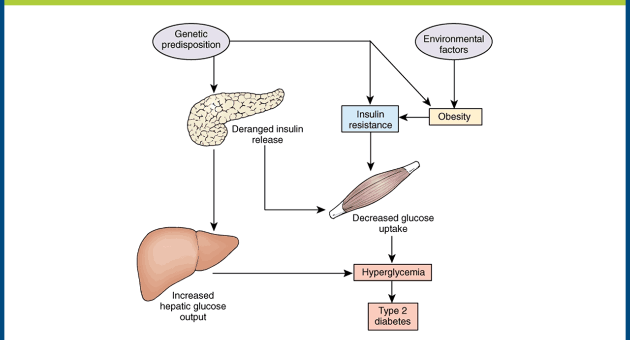 Pathophysiology of Diabetes Mellitus Type 2